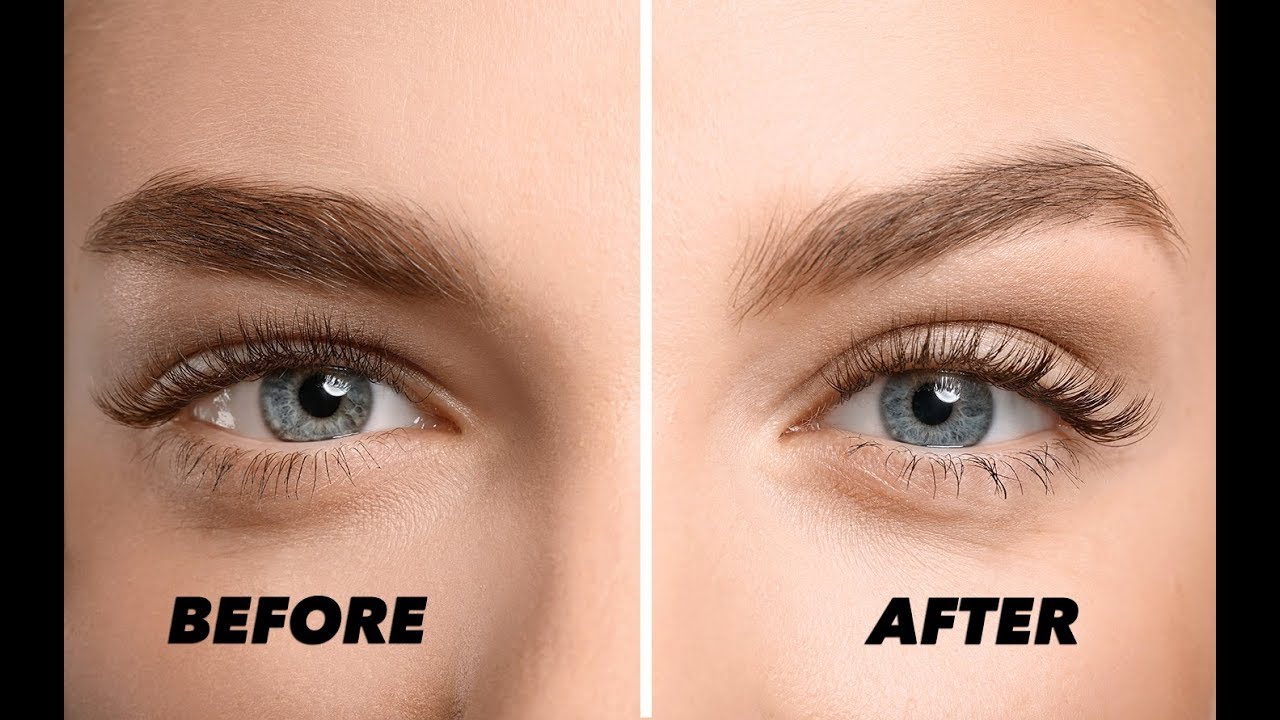 non surgical hooded eye treatment