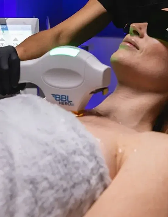 A BBL HERO handpiece treating the chest and décolleté during a ForeverBody pass at Medrein Health in Southlake, TX