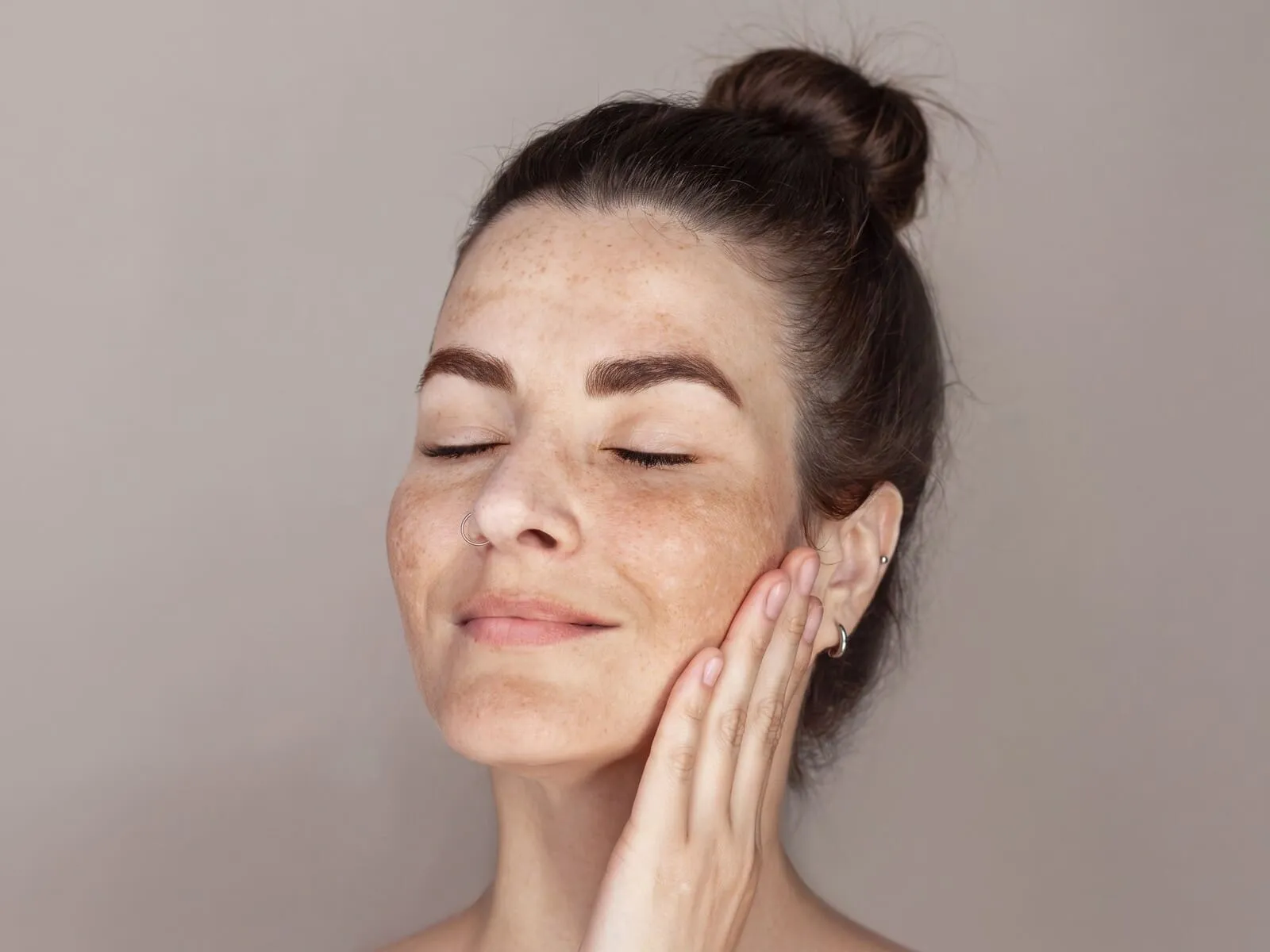 A woman with her eyes closed and her own fingertips resting flat against her cheek, freckling and soft light-brown melasma patches spread across both cheeks, the bridge of her nose and above her upper lip