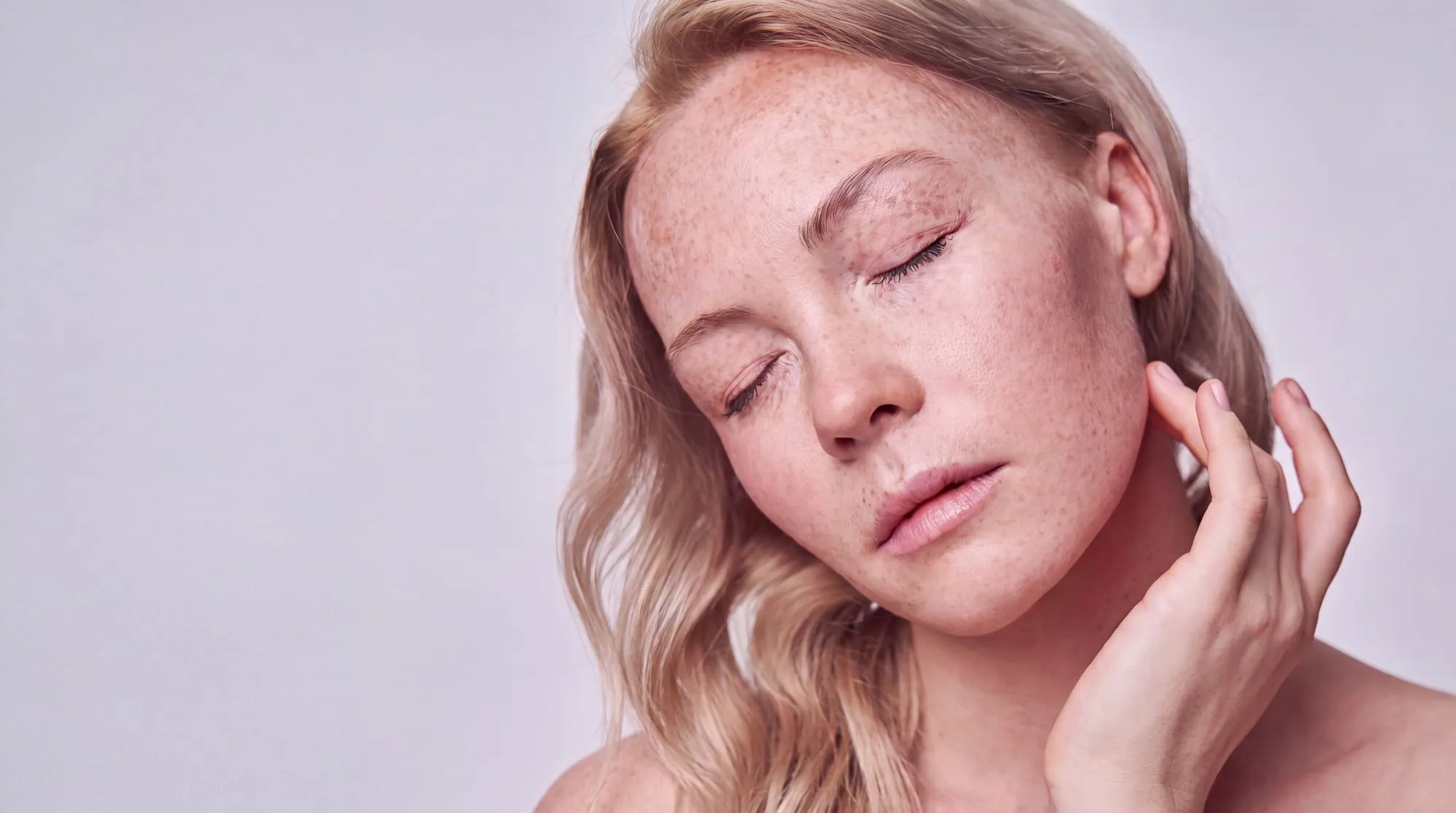 A woman with her eyes closed and her own fingertips at the side of her neck, dense freckling and flat tan sun spots scattered over her forehead, nose and cheeks with a soft sun-flushed patch across the near cheekbone