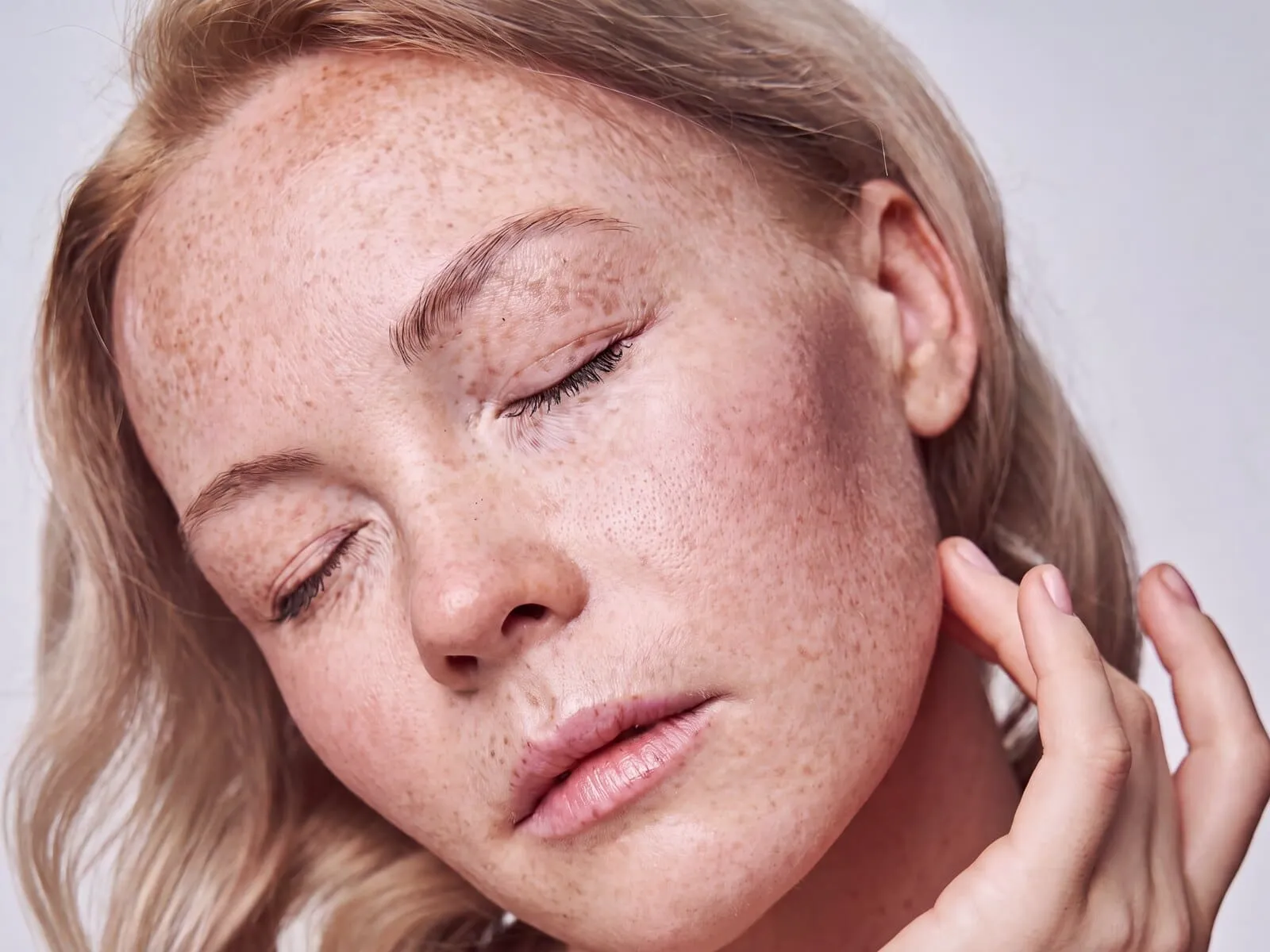 A woman with her eyes closed and her own fingertips at the side of her neck, dense freckling and flat tan sun spots scattered over her forehead, nose and cheeks with a soft sun-flushed patch across the near cheekbone