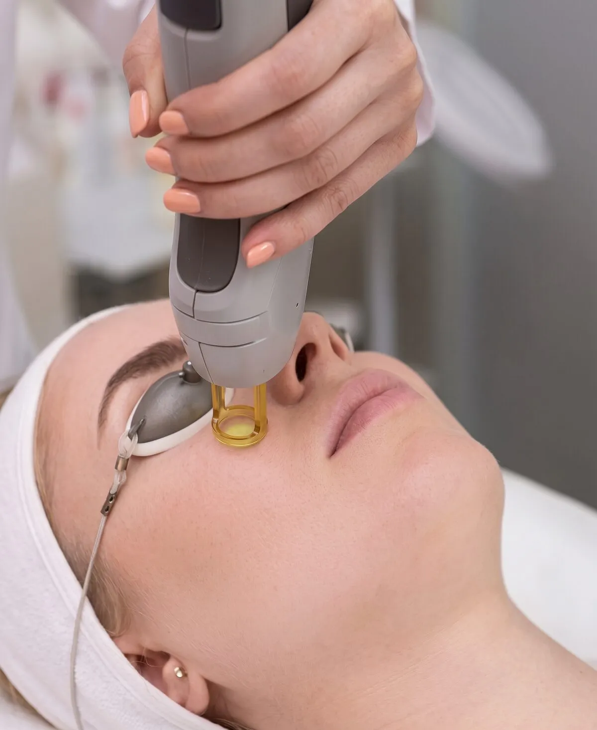 A patient in protective eyewear lying back as a clinician holds a Fotona laser handpiece with a glowing tip against the skin under her eye during a Fotona 4D facelift