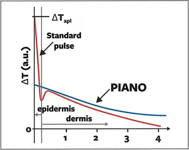 Graph from Medrein's treatment page plotting temperature rise against skin depth: a standard pulse spikes at the epidermis and falls away, while the PIANO pulse holds a lower, steadier rise further into the dermis