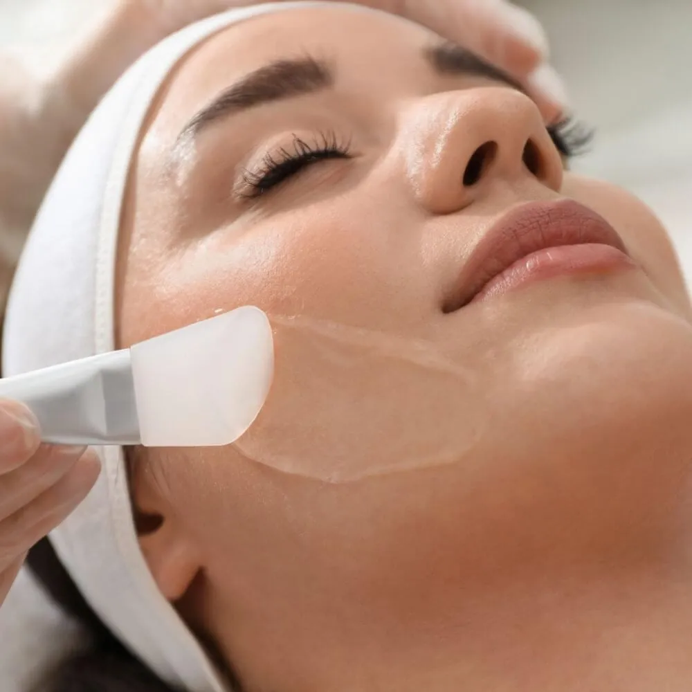 chemical peel before and after