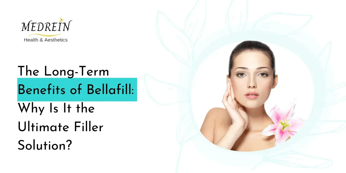 Long-Term Benefits of Bellafill: Why Is It the Ultimate Filler Solution?