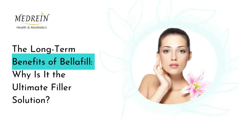 Long-Term Benefits of Bellafill: Why Is It the Ultimate Filler Solution?