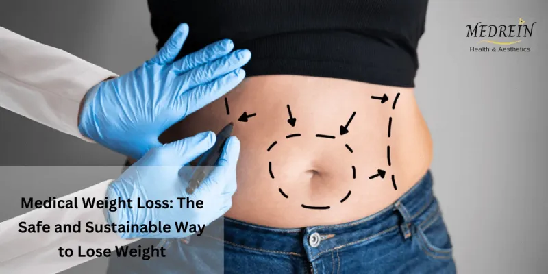 Medical Weight Loss: The Safe and Sustainable Ways