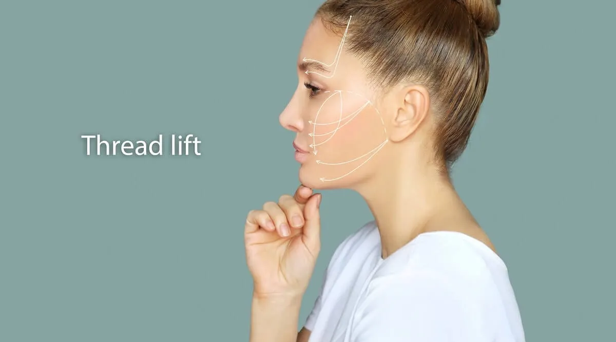 what is a pdo thread lift