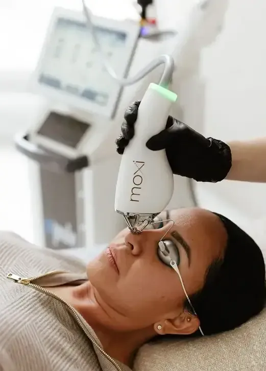 A gloved clinician passing the Sciton Moxi handpiece over a reclining patient's cheek, the patient wearing protective eye shields, with the Sciton console behind