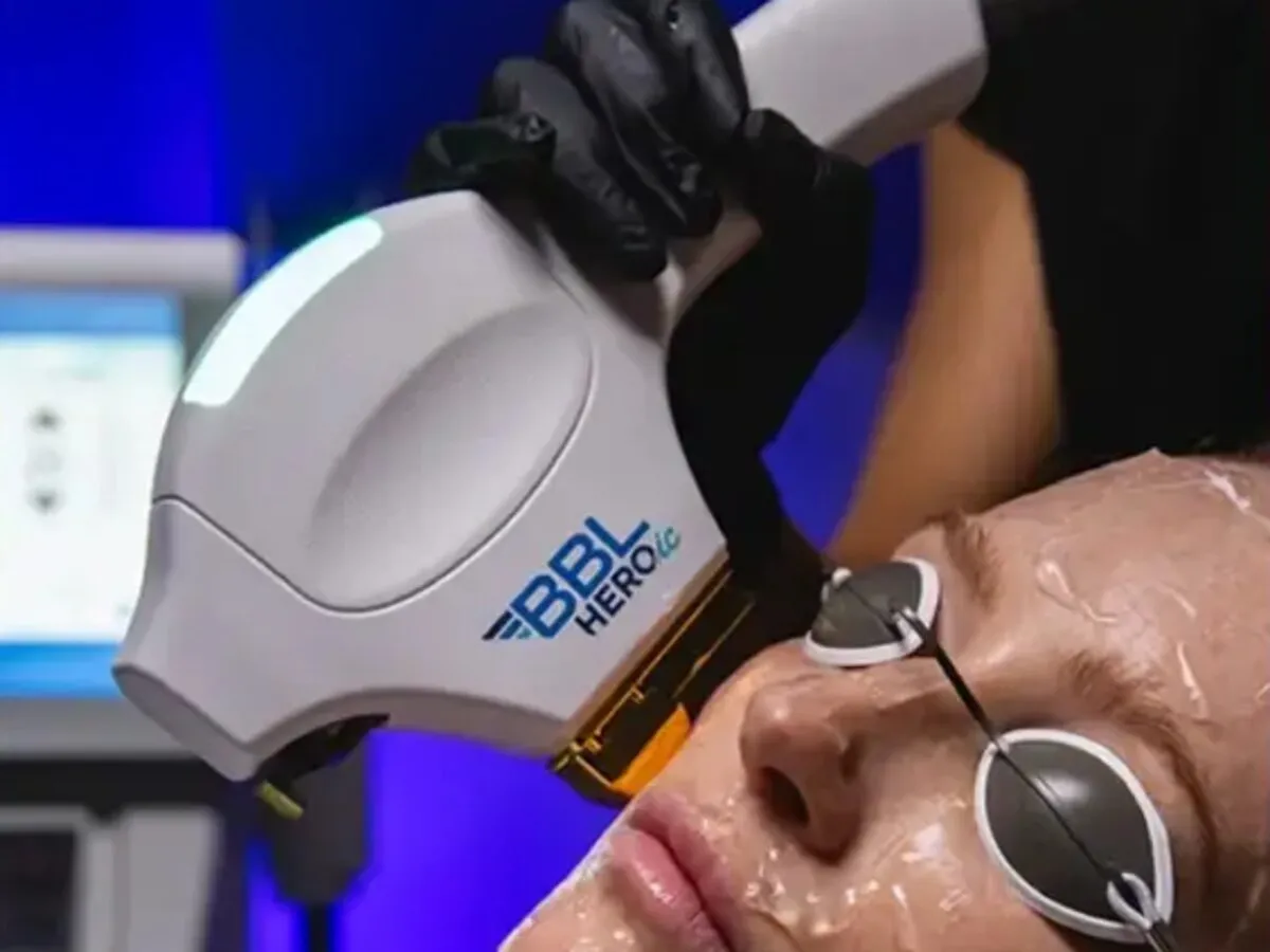 Clinician treating a patient’s face with the Sciton BBL HEROic handpiece