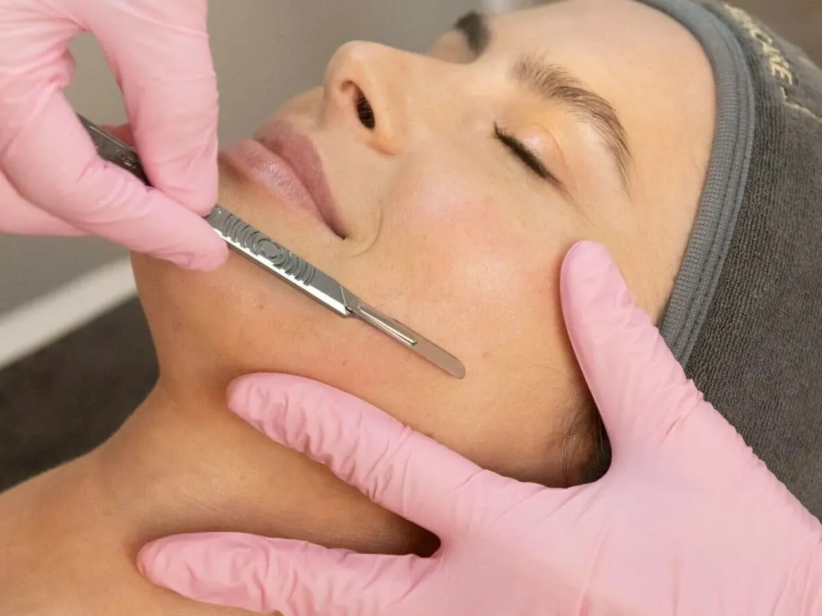 Clinician in pink gloves drawing a dermaplaning blade along a patient’s cheek to exfoliate the skin surface