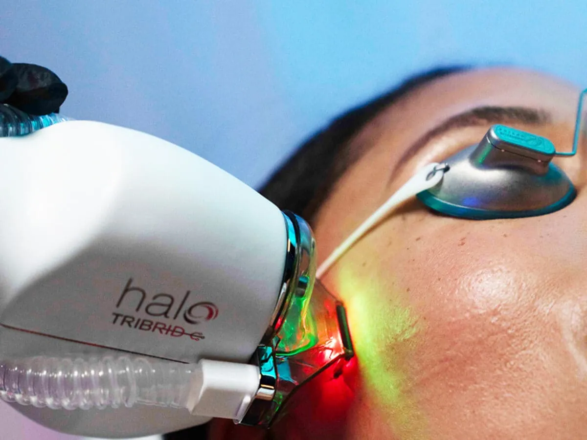 Sciton HALO TRIBRID handpiece being used on a patient’s face during a resurfacing session