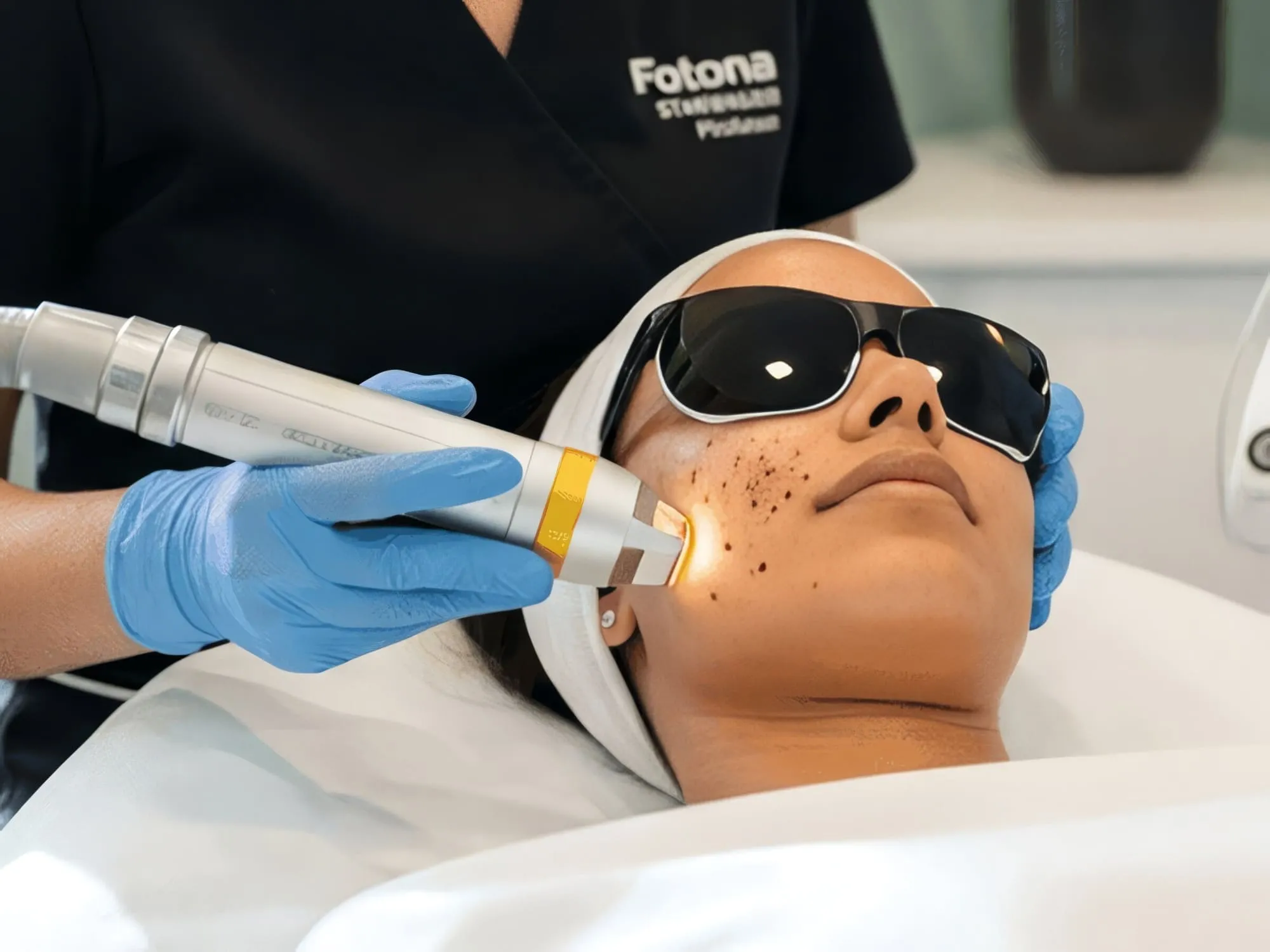 A Pico laser handpiece being used to treat pigment on a patient’s cheek