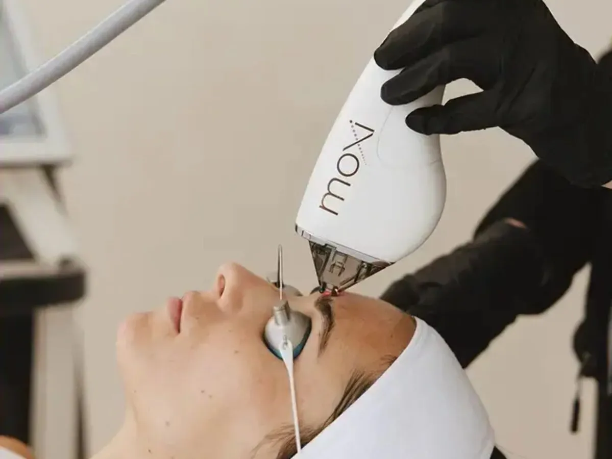 Clinician treating a patient’s face with the Sciton MOXI handpiece