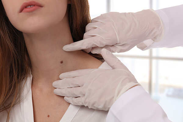 Say Goodbye to Ugly Skin Outgrowths with Our Cutting-Edge Skin Tag and Wart Removal Treatments