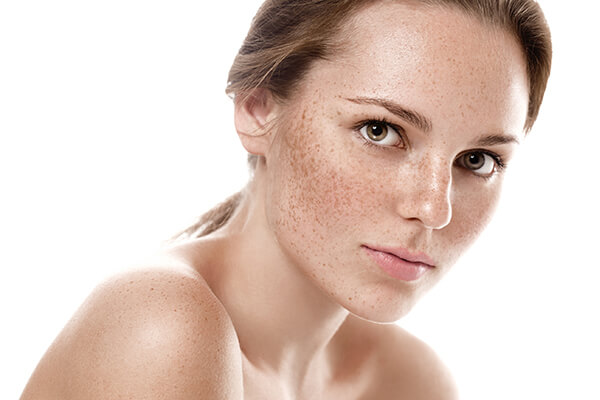 Hyperpigmentation Conditions that are commonly treated at Medrein Health