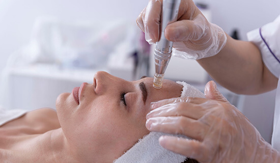 Microneedling with Stem Cell Growth Factors