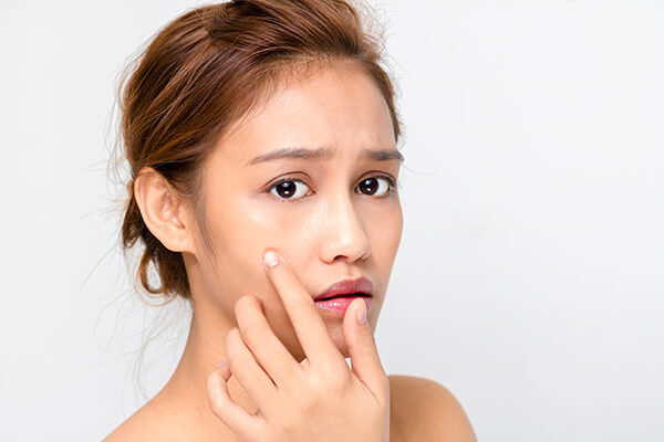 Medrein Health & Aesthetics: The One Place for All Your Acne and Scars Treatment