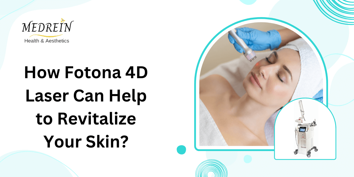 How Fotona 4D Laser Can Help to Revitalize Your Skin?