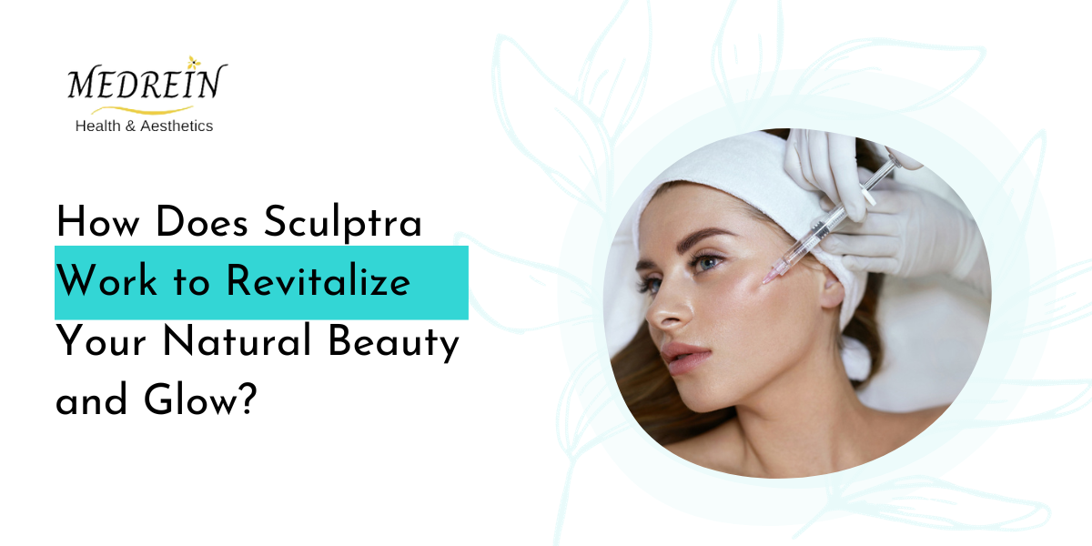 How Does Sculptra Work to Revitalize Your Natural Beauty and Glow?