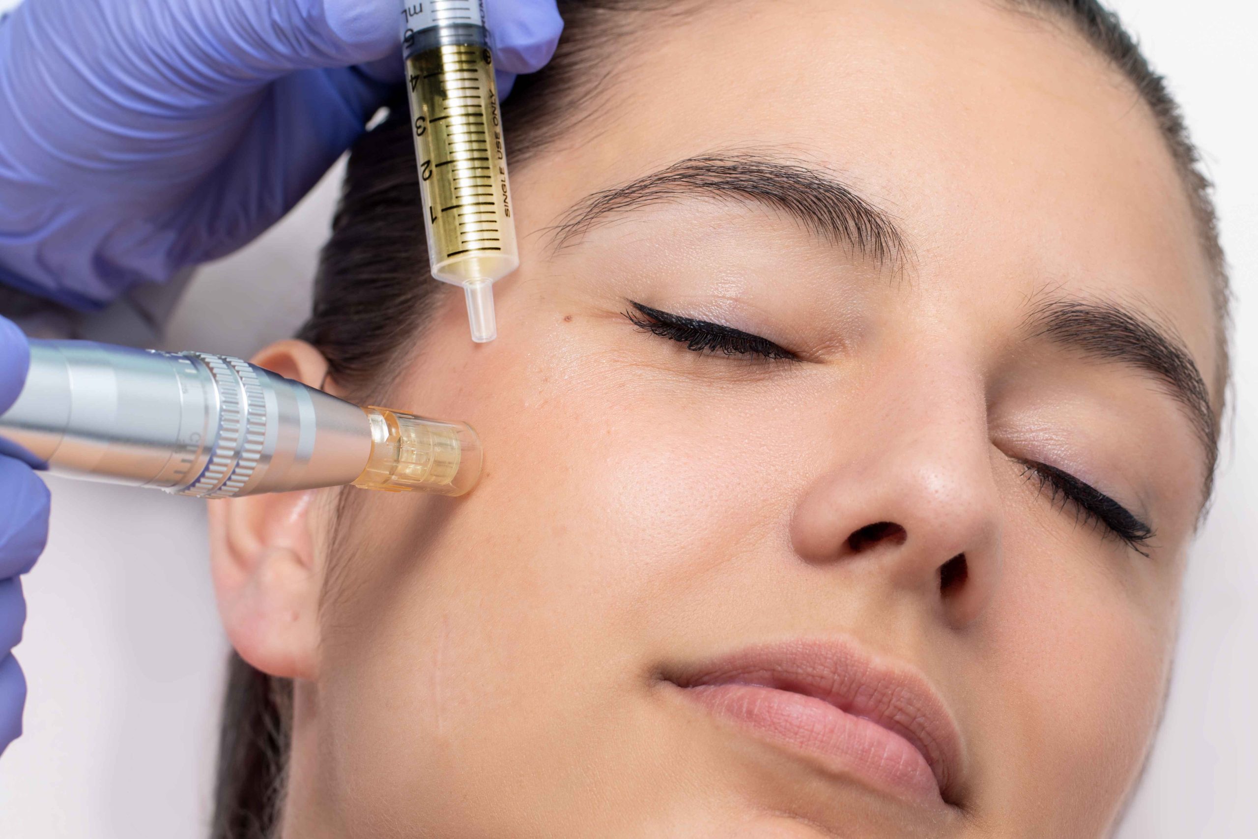Which is Better? Nano Needling Better or Microneedling?